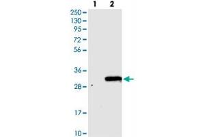 Western blot analysis of Lane 1: Negative control (vector only transfected HEK293T lysate), Lane 2: Over-expression Lysate (Co-expressed with a C-terminal myc-DDK tag (~3. (TVP23C/FAM18B2 抗体)