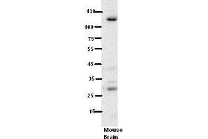 WB Suggested Anti-N6AMT1 Antibody Titration:  5% Milk  ELISA Titer:  dilution: 1:500  Positive Control:  Mouse Brain lysate (N6AMT1 抗体  (N-Term))
