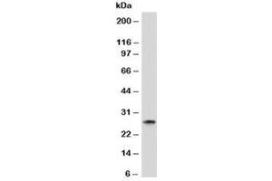 Western blot analysis of human spleen tissue and Kappa antibody. (小鼠 anti-人 Immunoglobulin kappa Chain Complex (Igk) Antibody)