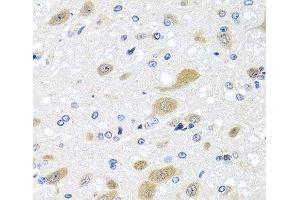 Immunohistochemistry of paraffin-embedded Rat brain using LCAT Polyclonal Antibody at dilution of 1:100 (40x lens). (LCAT 抗体)