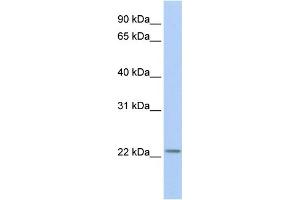 WB Suggested Anti-HIST1H1T Antibody Titration: 0. (Histone Cluster 1, H1t (HIST1H1T) (Middle Region) 抗体)