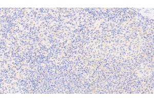 Detection of G6PD in Human Spleen Tissue using Polyclonal Antibody to Glucose-6-phosphate Dehydrogenase (G6PD)