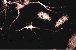 Immunofluorescent staining of Rat Neurons with anti-Adaptin gamma antibody. (gamma 1 Adaptin 抗体  (AA 642-821))
