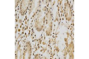 Immunohistochemistry of paraffin-embedded human stomach using HDAC6 antibody (ABIN5997884) at dilution of 1/100 (40x lens). (HDAC6 抗体)
