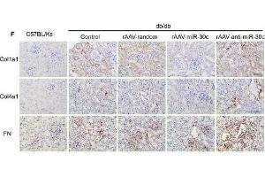 MiR-30c reduced fibrosis in DN via reducing TGF-β1 secretion from TECs. (COL4A1 抗体  (AA 1445-1669))