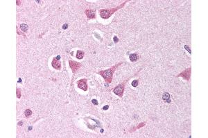 Anti-PPP4C antibody IHC of human brain, cortex. (PPP4C 抗体  (AA 294-307))