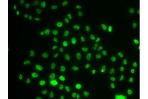 Immunofluorescence analysis of MCF-7 cells using PHIP antibody (ABIN6129078, ABIN6145556, ABIN6145557 and ABIN6223036). (PHIP 抗体  (AA 1542-1821))