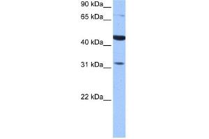 WB Suggested Anti-TPRXL Antibody Titration:  0. (TPRXL 抗体  (C-Term))