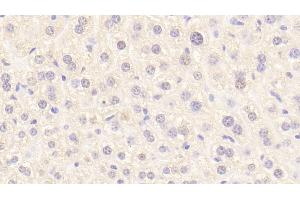 Detection of PROC in Mouse Liver Tissue using Polyclonal Antibody to Protein C (PROC) (PROC 抗体  (AA 197-436))