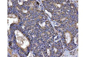 IHC analysis of TFEB using anti-TFEB antibody (ABIN7600648). (TFEB 抗体  (AA 214-326))