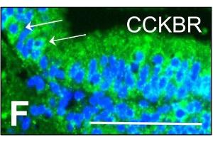 Homogenous, granular expression of CCKBR is seen within the neuroepithelial cells, with intense perinuclear labelling. (CCKBR 抗体  (AA 301-400))