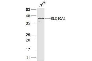 Mouse liver lysate probed with SLC10A2 Polyclonal Antibody  at 1:300 overnight at 4˚C. (SLC10A2 抗体  (AA 131-230))