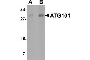 Western Blotting (WB) image for anti-Chromosome 12 Open Reading Frame 44 (C12orf44) (Middle Region) antibody (ABIN1030867) (ATG101 抗体  (Middle Region))