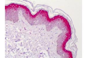 Human Skin: Formalin-Fixed, Paraffin-Embedded (FFPE) (STEAP4 抗体)