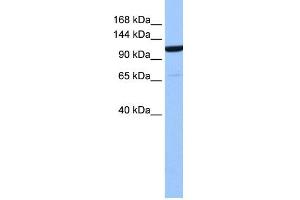 WB Suggested Anti-NUP155 Antibody Titration: 0. (NUP155 抗体  (Middle Region))