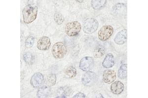 Immunohistochemistry (IHC) image for anti-Histone Deacetylase 7 (HDAC7) (AA 902-952) antibody (ABIN7448594)