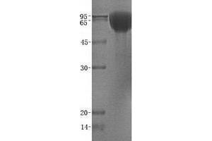 Western Blotting (WB) image for Neurotrophic Tyrosine Kinase, Receptor, Type 2 (NTRK2) (Transcript Variant B) protein (ABIN2734335)