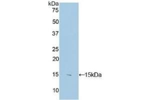 Detection of Recombinant S100B, Human using Polyclonal Antibody to S100 Calcium Binding Protein B (S100B) (S100B 抗体  (AA 1-92))