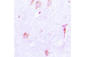 Immunohistochemical analysis of Cathepsin E staining in human brain formalin fixed paraffin embedded tissue section. (Cathepsin E 抗体  (Center))