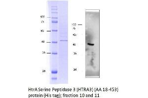 Western Blotting (WB) image for HtrA Serine Peptidase 3 (HTRA3) (AA 18-453) protein (His tag) (ABIN3092994)
