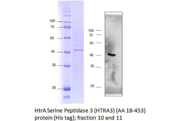 HTRA3 Protein (AA 18-453) (His tag)