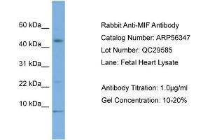 Western Blotting (WB) image for anti-Macrophage Migration Inhibitory Factor (Glycosylation-Inhibiting Factor) (MIF) (Middle Region) antibody (ABIN2786654)