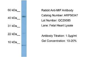 WB Suggested Anti-MIF  Antibody Titration: 0. (MIF 抗体  (Middle Region))