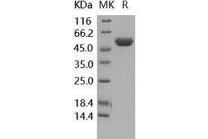 TIMP2 Protein (Fc Tag)