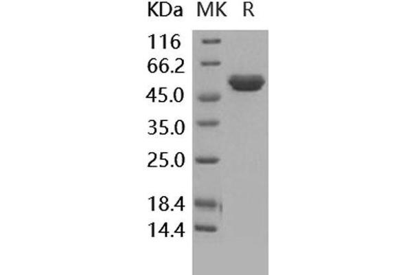 TIMP2 Protein (Fc Tag)