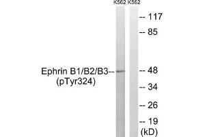 Western blot analysis of extracts from K562 cells treated with serum using Ephrin B1/B2/B3 (Phospho-Tyr324) Antibody. (EFNB1/EFNB2/EFNB3 (pTyr324) 抗体)