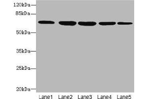 Western blot All lanes: ILVBL antibody at 4 μg/mL Lane 1: HepG2 whole cell lysate Lane 2: Hela whole cell lysate Lane 3: A549 whole cell lysate Lane 4: Jurkat whole cell lysate Lane 5: U87 whole cell lysate Secondary Goat polyclonal to rabbit IgG at 1/10000 dilution Predicted band size: 68 kDa Observed band size: 68 kDa (ILVBL 抗体  (AA 45-344))