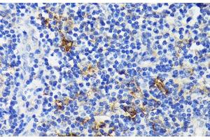 Immunohistochemistry of paraffin-embedded Human tonsil using TREM2 Polyclonal Antibody at dilution of 1:200 (40x lens). (TREM2 抗体)