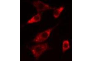 ABIN6276064 staining  Hela cells by IF/ICC. (NTSR1 抗体  (Internal Region))