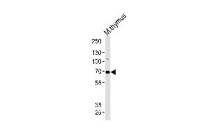 Western blot analysis of lysate from mouse thymus tissue lysate, using Mouse Ephb6 Antibody (Center) (ABIN1881301 and ABIN2838401). (EPH Receptor B6 抗体  (AA 503-530))