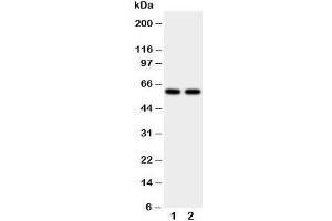 Western blot testing of CYP11A1 antibody and human placenta tissue lysate. (CYP11A1 抗体  (C-Term))