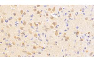 Immunohistochemistry (IHC) image for anti-Ubiquitin Carboxyl-terminal Esterase L1 (Ubiquitin Thiolesterase) (UCHL1) (AA 2-223) antibody (ABIN7440260)