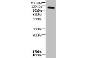 Western blot All lanes: DIS3L antibody at 6 μg/mL + MCF-7 whole cell lysate Secondary Goat polyclonal to rabbit IgG at 1/10000 dilution Predicted band size: 121, 106, 87, 112 kDa Observed band size: 121 kDa (DIS3L 抗体  (AA 1-300))