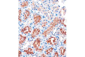 Immunohistochemistry of paraffin-embedded Rat kidney using IQG Rabbit pAb (ABIN7268022) at dilution of 1:100 (40x lens). (IQGAP2 抗体  (AA 1330-1440))