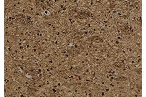 ABIN6278641 at 1/100 staining Rat brain tissue by IHC-P. (T-Box 15/18 抗体)