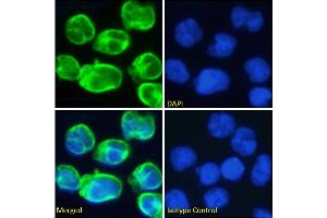Immunofluorescence staining of fixed Molt4 cells with anti-CD3 epsilon antibody OKT-3. (Recombinant CD3E (Muromonab Biosimilar) 抗体)