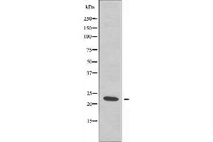 Western blot analysis of extracts from COLO205 cells, using RPS5 antibody. (RPS5 抗体  (Internal Region))