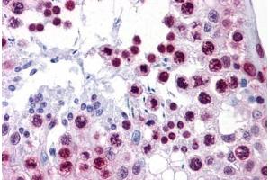 Human Testis: Formalin-Fixed, Paraffin-Embedded (FFPE) (HMGB1 抗体  (AA 1-91))