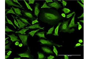 Immunofluorescence (IF) image for anti-Ring Finger Protein 2 (RNF2) (AA 192-290) antibody (ABIN519808)