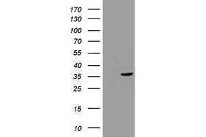 Image no. 1 for anti-Thymidylate Synthetase (TYMS) antibody (ABIN1501597) (TYMS 抗体)