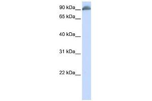 EPB41 antibody used at 1 ug/ml to detect target protein. (EPB41 抗体  (N-Term))