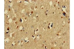 Immunohistochemistry of paraffin-embedded human brain tissue using ABIN7171209 at dilution of 1:100 (SNCAIP 抗体  (AA 309-553))
