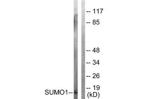 Western Blotting (WB) image for anti-Small Ubiquitin Related Modifier Protein 1 (SUMO1) (N-Term) antibody (ABIN1848853) (SUMO1 抗体  (N-Term))