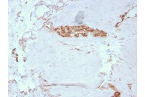 Formalin-fixed, paraffin-embedded human Colon stained with Fodrin Mouse Monoclonal Antibody (SPTAN1/3351). (SPTAN1 抗体  (AA 2351-2475))