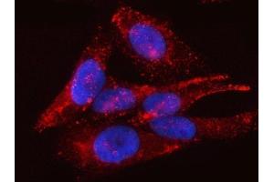 IF analysis of PTRF/CAVIN1 using anti-PTRF/CAVIN1 antibody (ABIN7601817). (PTRF 抗体  (AA 47-390))