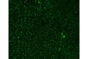 Immunofluorescent testing of colon carcinoma with Alexa Fluor 488 conjugated Nucleoli marker antibody.